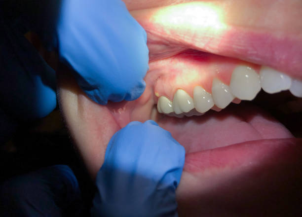 Best Orthodontic Emergency Dentist in Zephyrhills South, FL